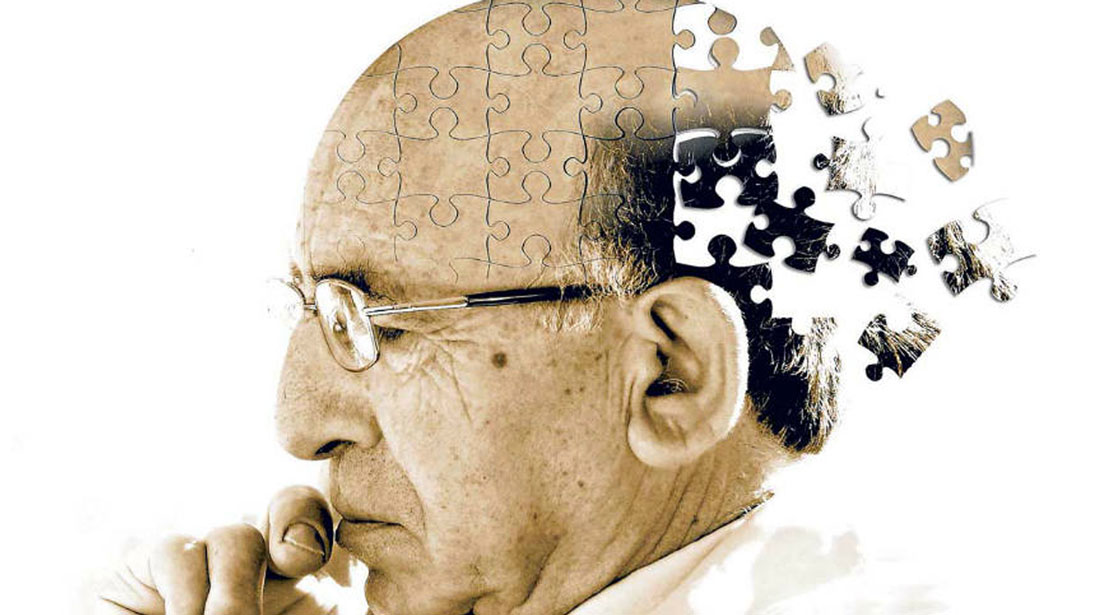 Understanding Alzheimer’s Disease